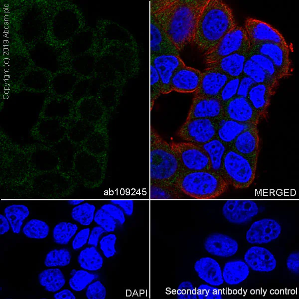 Immunocytochemistry/ Immunofluorescence - Anti-SOCS2 antibody [EPR2588(2)] - BSA and Azide free (AB247806)