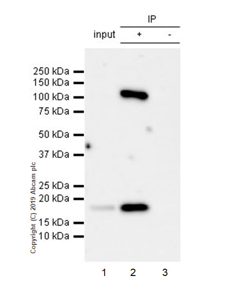Immunoprecipitation - Anti-SOCS2 antibody [EPR2588(2)] - BSA and Azide free (AB247806), expandable thumbnail