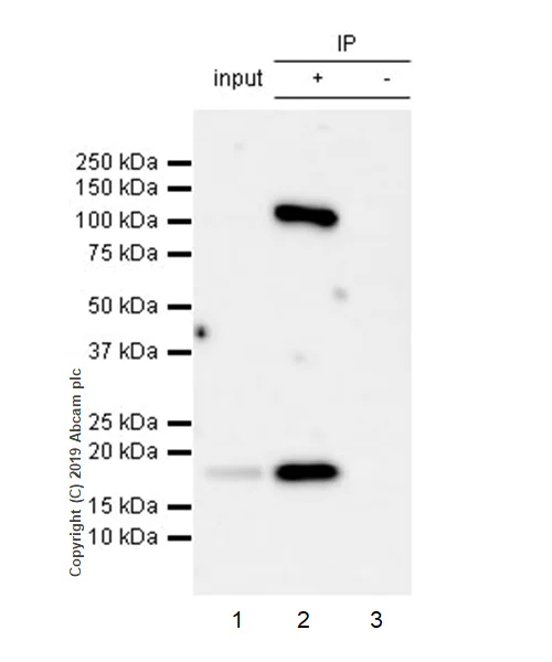 Immunoprecipitation - Anti-SOCS2 antibody [EPR2588(2)] - BSA and Azide free (AB247806)