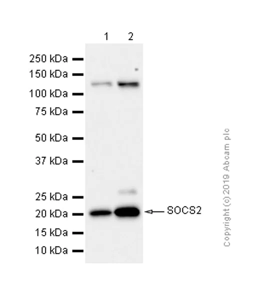 Western blot - Anti-SOCS2 antibody [EPR2588(2)] - BSA and Azide free (AB247806)
