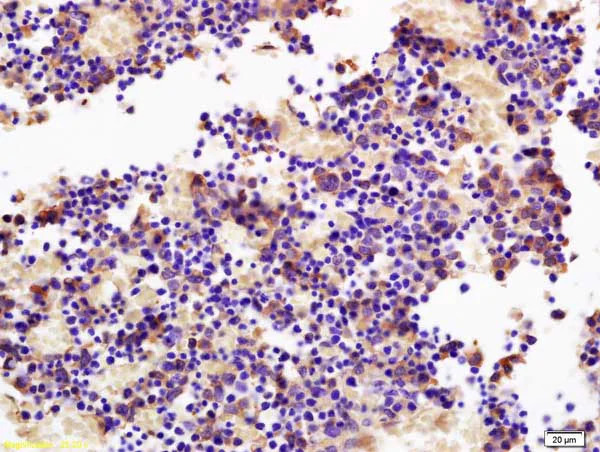 Immunohistochemistry (Formalin/PFA-fixed paraffin-embedded sections) - Anti-SOCS3 antibody (AB216570)