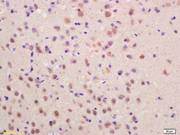 Immunohistochemistry (Formalin/PFA-fixed paraffin-embedded sections) - Anti-SOCS3 antibody (AB216570)