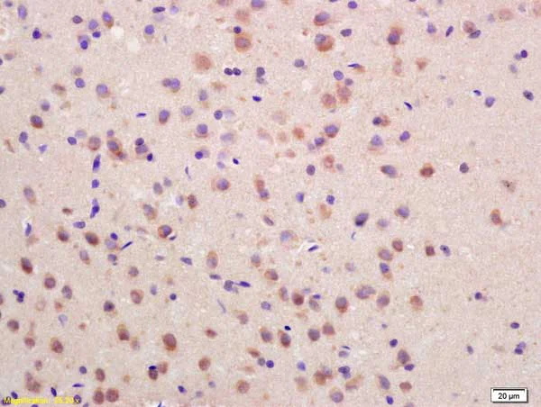 Immunohistochemistry (Formalin/PFA-fixed paraffin-embedded sections) - Anti-SOCS3 antibody (AB216570)