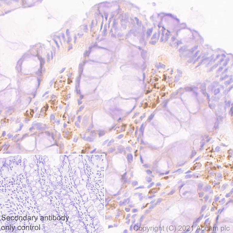 Immunohistochemistry (Formalin/PFA-fixed paraffin-embedded sections) - Anti-SOCS3 antibody [EPR24090-74] (AB280884)