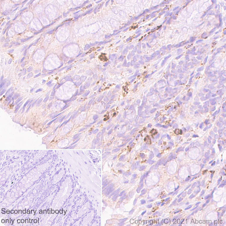 Immunohistochemistry (Formalin/PFA-fixed paraffin-embedded sections) - Anti-SOCS3 antibody [EPR24090-74] (AB280884)