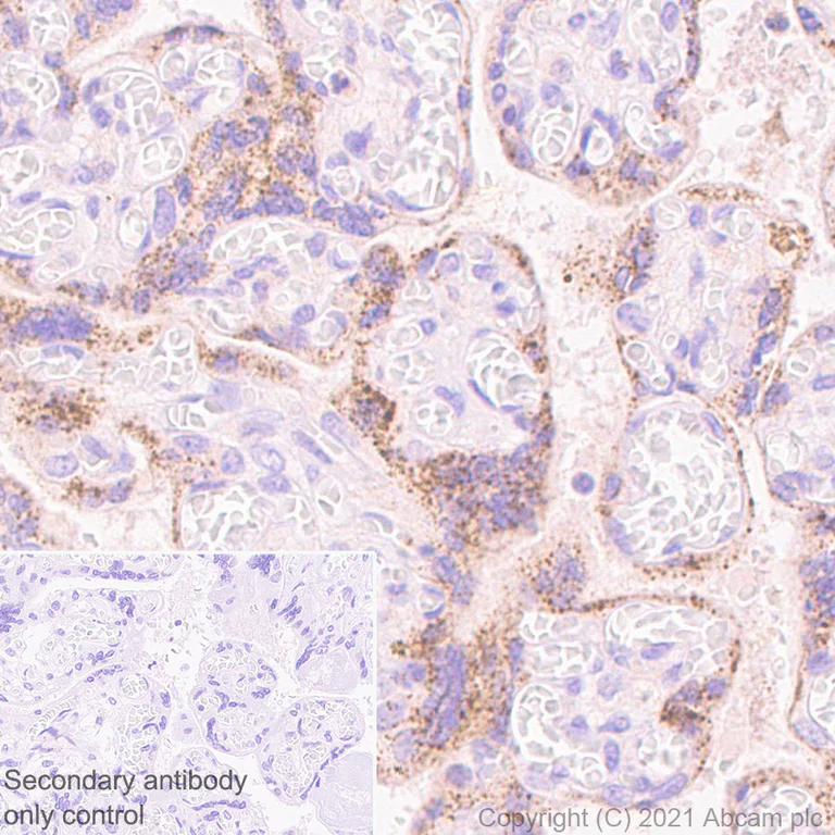 Immunohistochemistry (Formalin/PFA-fixed paraffin-embedded sections) - Anti-SOCS3 antibody [EPR24090-74] (AB280884)