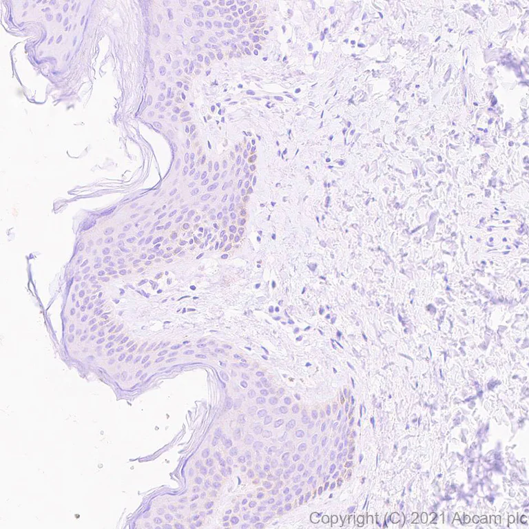Immunohistochemistry (Formalin/PFA-fixed paraffin-embedded sections) - Anti-SOCS3 antibody [EPR24090-74] (AB280884)