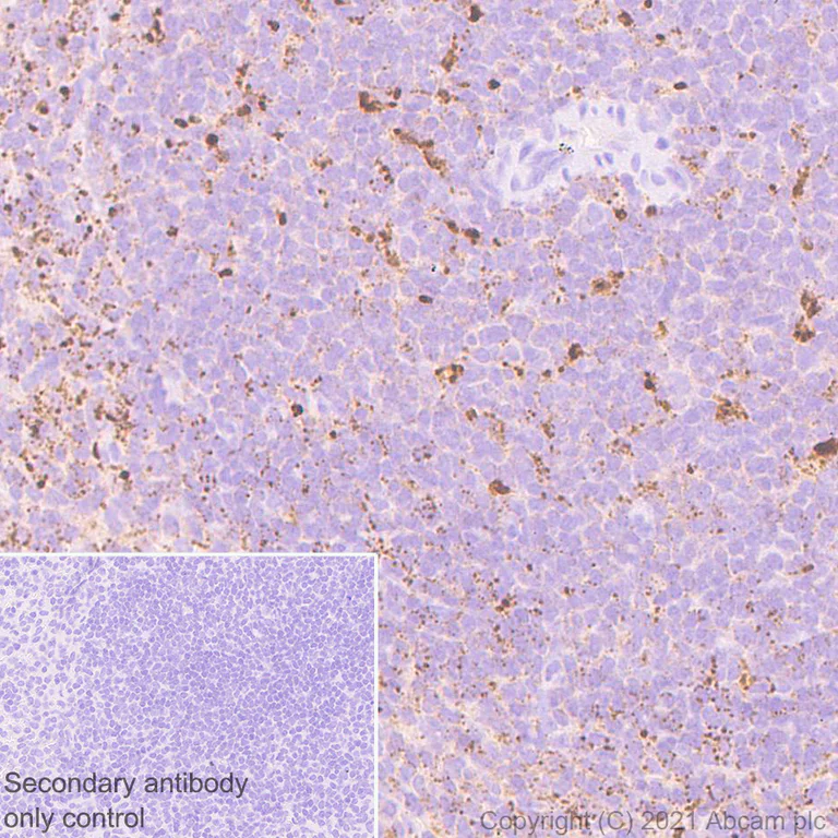 Immunohistochemistry (Formalin/PFA-fixed paraffin-embedded sections) - Anti-SOCS3 antibody [EPR24090-74] (AB280884)