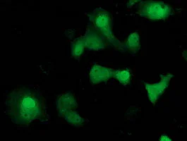 Immunocytochemistry/ Immunofluorescence - Anti-SOCS3 antibody [OTI3D3] (AB236519)