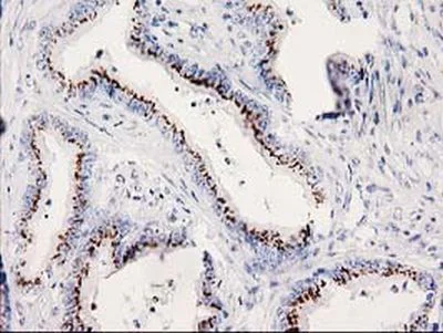 Immunohistochemistry (Formalin/PFA-fixed paraffin-embedded sections) - Anti-SOCS3 antibody [OTI3D3] (AB236519)