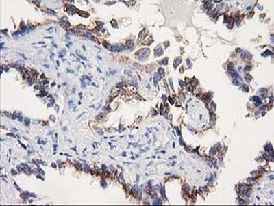 Immunohistochemistry (Formalin/PFA-fixed paraffin-embedded sections) - Anti-SOCS3 antibody [OTI3D3] (AB236519)