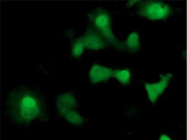 Immunocytochemistry/ Immunofluorescence - Anti-SOCS3 antibody [OTI3D3] - BSA and Azide free (AB273652)