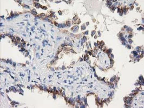 Immunohistochemistry (Formalin/PFA-fixed paraffin-embedded sections) - Anti-SOCS3 antibody [OTI3D3] - BSA and Azide free (AB273652)