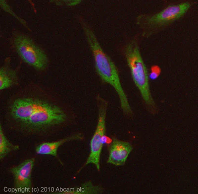 Immunocytochemistry/ Immunofluorescence - Anti-SOCS3 antibody [SO1] (AB14939)
