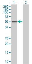 Western blot - SOCS4 overexpression 293T lysate (whole cell) (AB94295), expandable thumbnail