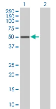 Western blot - SOCS4 overexpression 293T lysate (whole cell) (AB94295)