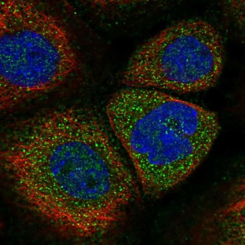 Immunocytochemistry/ Immunofluorescence - Anti-SOCS5 antibody (AB244384)