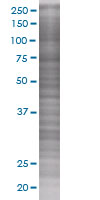 SOCS5 overexpression 293T lysate (whole cell)