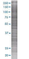 SDS-PAGE - SOCS5 overexpression 293T lysate (whole cell) (AB94296)