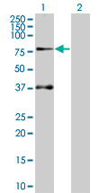 Western blot - SOCS5 overexpression 293T lysate (whole cell) (AB94296)
