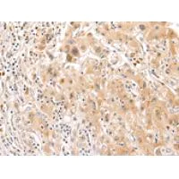 Immunohistochemistry (Formalin/PFA-fixed paraffin-embedded sections) - Anti-SOCS6 antibody (AB197335)