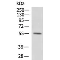 Western blot - Anti-SOCS6 antibody (AB197335)
