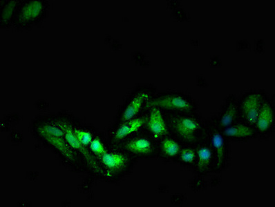 Immunocytochemistry/ Immunofluorescence - Anti-SOCS7 antibody (AB224589)