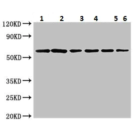 Western blot - Anti-SOCS7 antibody (AB224589)
