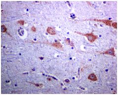 Immunohistochemistry (Formalin/PFA-fixed paraffin-embedded sections) - Anti-SOCS7 antibody [EPR8466] (AB133677)