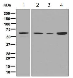 Western blot - Anti-SOCS7 antibody [EPR8466] (AB133677)