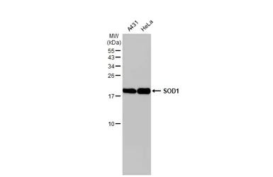 Western blot - Anti-SOD1 antibody [HL1653] - BSA and Azide free (AB308181)