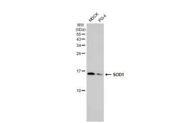 Western blot - Anti-SOD1 antibody [HL1653] - BSA and Azide free (AB308181)