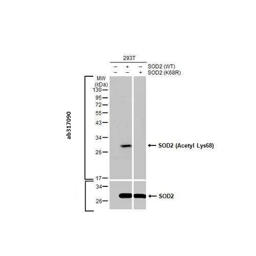 Western blot - Anti-SOD2 antibody [HL1483] (AB317090)