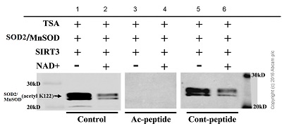 Western blot - Anti-SOD2/MnSOD (acetyl K122) antibody [NCI-R156-33] - BSA and Azide free (AB240391)
