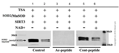 Western blot - Anti-SOD2/MnSOD (acetyl K122) antibody [NCI-R156-33] - BSA and Azide free (AB240391)