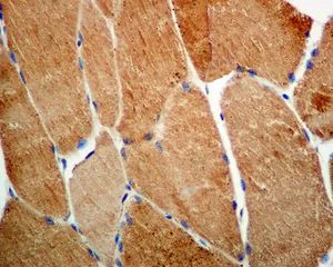 Immunohistochemistry (Formalin/PFA-fixed paraffin-embedded sections) - Anti-SOD2/MnSOD (acetyl K68) antibody [EPVANR2] (AB137037)