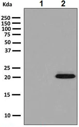 Western blot - Anti-SOD2/MnSOD (acetyl K68) antibody [EPVANR2] (AB137037)