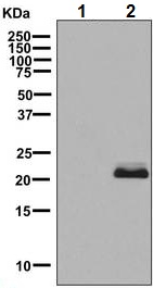 Western blot - Anti-SOD2/MnSOD (acetyl K68) antibody [EPVANR2] (AB137037)