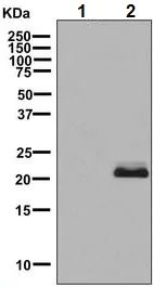 Western blot - Anti-SOD2/MnSOD (acetyl K68) antibody [EPVANR2] (AB137037)