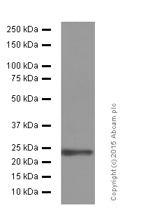Western blot - Anti-SOD2/MnSOD (acetyl K68) antibody [EPVANR2] (AB137037)