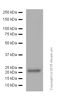 Western blot - Anti-SOD2/MnSOD (acetyl K68) antibody [EPVANR2] (AB137037)