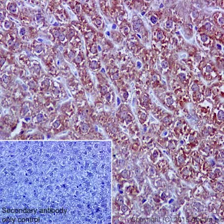 Immunohistochemistry (Formalin/PFA-fixed paraffin-embedded sections) - Anti-SOD2/MnSOD (acetyl K68) antibody [EPVANR2] - BSA and Azide free (AB218529)