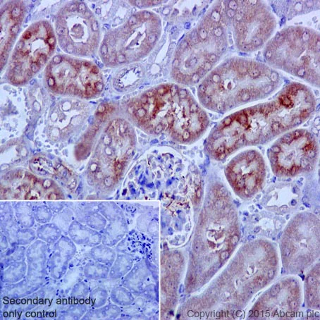 Immunohistochemistry (Formalin/PFA-fixed paraffin-embedded sections) - Anti-SOD2/MnSOD (acetyl K68) antibody [EPVANR2] - BSA and Azide free (AB218529)