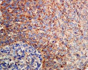 Immunohistochemistry (Formalin/PFA-fixed paraffin-embedded sections) - Anti-SOD2/MnSOD (acetyl K68) antibody [EPVANR2] - BSA and Azide free (AB218529)