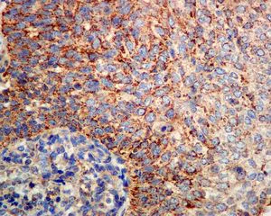 Immunohistochemistry (Formalin/PFA-fixed paraffin-embedded sections) - Anti-SOD2/MnSOD (acetyl K68) antibody [EPVANR2] - BSA and Azide free (AB218529)