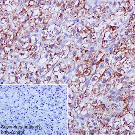 Immunohistochemistry (Formalin/PFA-fixed paraffin-embedded sections) - Anti-SOD2/MnSOD (acetyl K68) antibody [EPVANR2] - BSA and Azide free (AB218529)