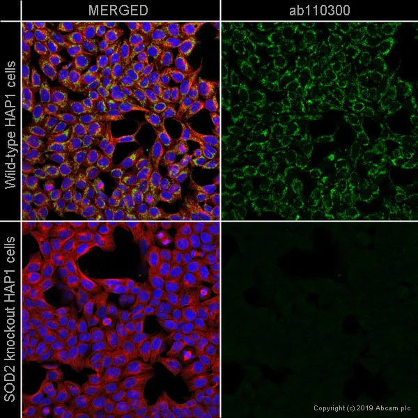 Immunocytochemistry/ Immunofluorescence - Anti-SOD2/MnSOD antibody [9E2BD2] (AB110300)
