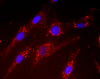 Immunocytochemistry/ Immunofluorescence - Anti-SOD2/MnSOD antibody [9E2BD2] (AB110300)