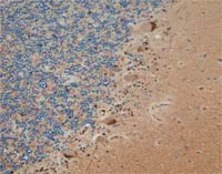 Immunohistochemistry (Formalin/PFA-fixed paraffin-embedded sections) - Anti-SOD2/MnSOD antibody [9E2BD2] (AB110300)