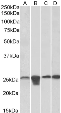 Western blot - Anti-SOD2/MnSOD antibody (AB118340)